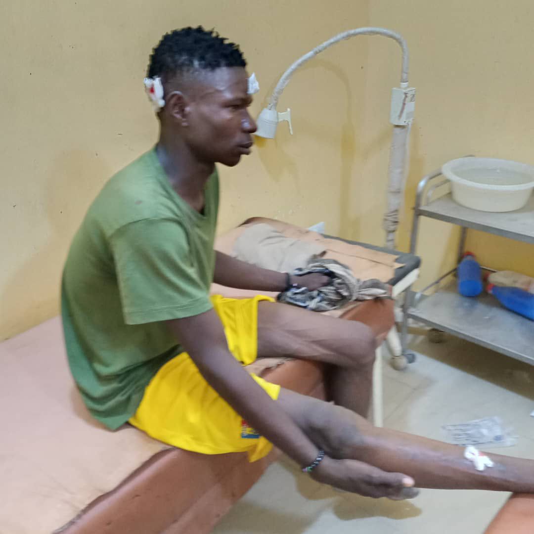 Hunters Group in Yobe Alleges Assault on Member by Police Personnel