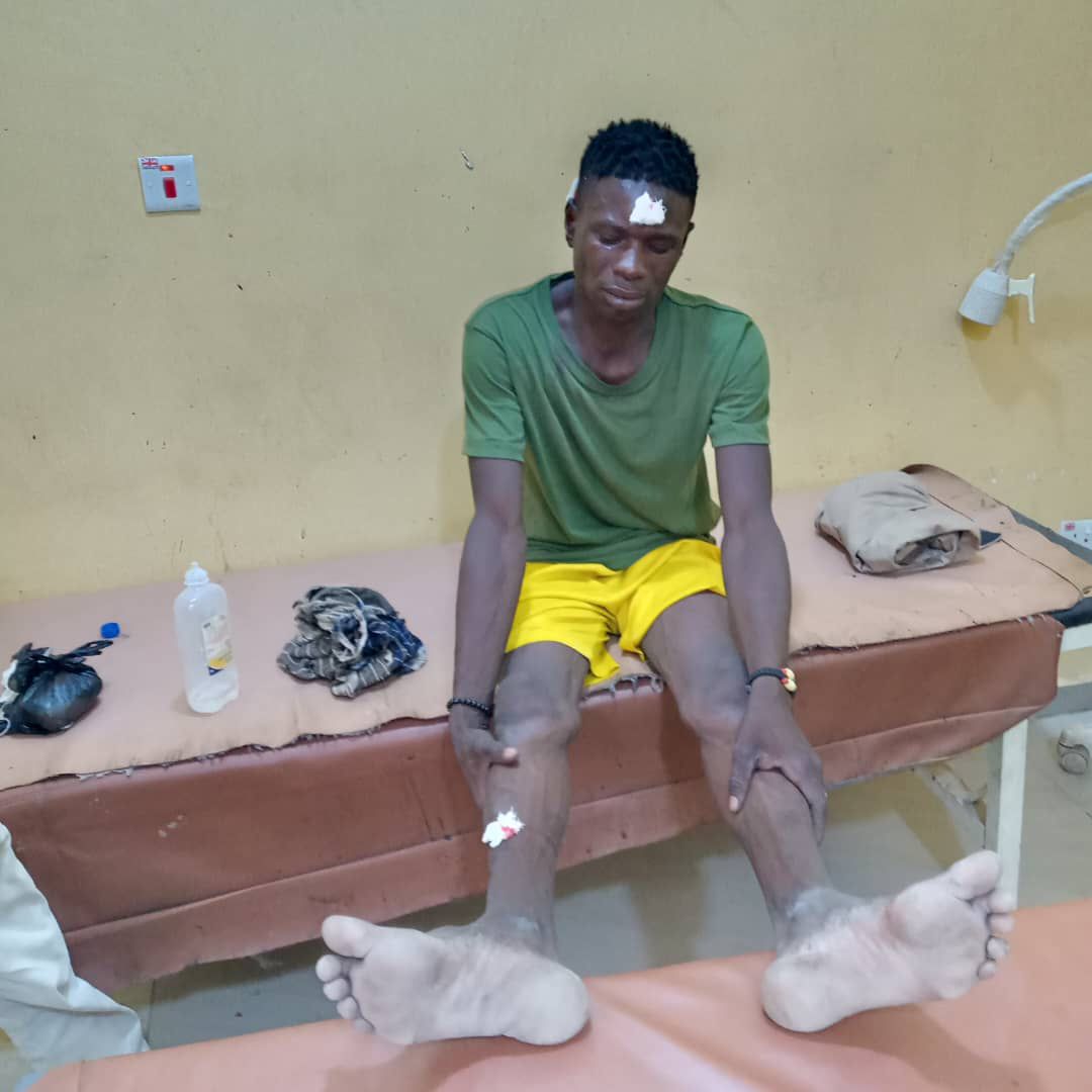 Hunters Group in Yobe Alleges Assault on Member by Police Personnel